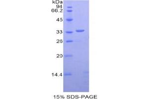 SDS-PAGE analysis of Human Dystrophin Protein. (Dystrophin Protein (DMD))