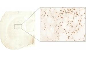 Immunohistochemistry (IHC) image for anti-Huntingtin (HTT) (AA 85-200) antibody (ABIN6254174) (Huntingtin antibody  (AA 85-200))