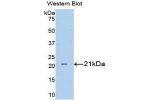 Western Blotting (WB) image for anti-Interleukin 7 Receptor (IL7R) (AA 48-217) antibody (ABIN3205856) (IL7R antibody  (AA 48-217))
