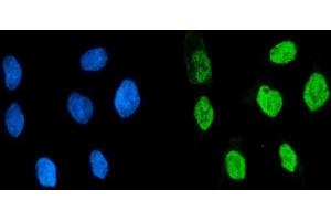 IF analysis of KHSRP using anti-KHSRP antibody (ABIN7599776).
