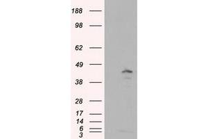 Image no. 1 for anti-Induced Myeloid Leukemia Cell Differentiation Protein Mcl-1 (MCL1) antibody (ABIN1499342) (MCL-1 antibody)
