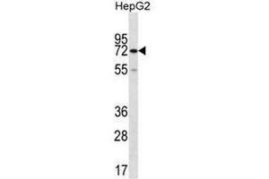 CTPS2 Antibody (C-term) western blot analysis in HepG2 cell line lysates (35µg/lane). (CTPS2 antibody  (C-Term))