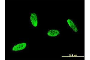 Immunofluorescence of monoclonal antibody to SOX8 on HeLa cell. (SOX8 antibody  (AA 102-210))