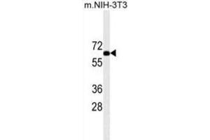 Western Blotting (WB) image for anti-Ribosomal Protein S6 Kinase, 70kDa, Polypeptide 2 (RPS6KB2) antibody (ABIN2909954)