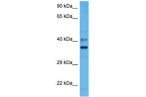 Host:  Mouse  Target Name:  PARD6A  Sample Tissue:  Mouse Liver  Antibody Dilution:  1ug/ml (PARD6A antibody  (N-Term))