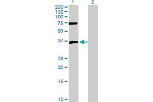 Western Blot analysis of MEOX2 expression in transfected 293T cell line by MEOX2 MaxPab polyclonal antibody. (MEOX2 antibody  (AA 1-303))