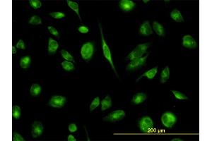 Immunofluorescence of monoclonal antibody to TCP1 on HeLa cell.