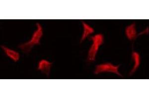ABIN6275551 staining COLO205 by IF/ICC. (PPP4R1L antibody)