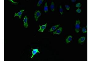 Immunofluorescent analysis of A549 cells using ABIN7163353 at dilution of 1:100 and Alexa Fluor 488-congugated AffiniPure Goat Anti-Rabbit IgG(H+L) (PPAP2C antibody  (AA 109-162))