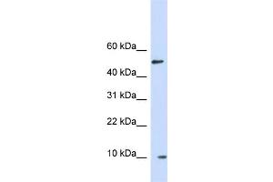 WB Suggested Anti-ERH Antibody Titration: 1. (ERH antibody  (Middle Region))