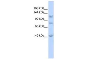 Image no. 1 for anti-DEAH (Asp-Glu-Ala-His) Box Polypeptide 30 (DHX30) (N-Term) antibody (ABIN6742683) (DHX30 antibody  (N-Term))