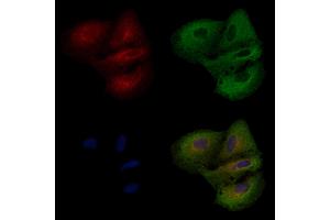 ABIN6258500 and ABIN6274589 staining  cells by IF/ICC. (ARRDC3 antibody  (C-Term))