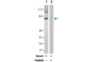 Western blot analysis of extracts from COS-7 cells, treated with Serum (10 %, 30 mins), using DAXX polyclonal antibody . (DAXX antibody)