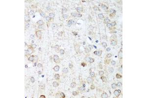 Immunohistochemistry of paraffin-embedded mouse brain using ANKRD52 antibody. (ANKRD52 antibody  (AA 450-660))