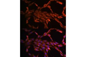 Immunofluorescence analysis of NIH-3T3 cells using P antibody (ABIN7269144). (PAK1 antibody)