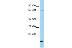 WB Suggested Anti-TIMM23B Antibody Titration: 1. (TIMM23B antibody  (N-Term))