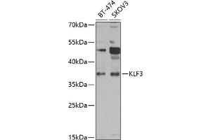 Western blot analysis of extracts of various cell lines, using KLF3 antibody (ABIN6130892, ABIN6142918, ABIN6142919 and ABIN6223018) at 1:1000 dilution. (KLF3 antibody  (AA 1-240))