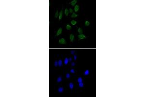 Immunofluorescence analysis of HeLa cells using CHD3 monoclonal antibody, clone 2G4  (green). (CHD3 antibody)