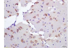 Formalin-fixed and paraffin embedded rat brain labeled with Rabbit Anti-Ceramide synthase 2 Polyclonal Antibody, Unconjugated  at 1:200 followed by conjugation to the secondary antibody and DAB staining (Ceramide Synthase 2 antibody  (AA 201-300))