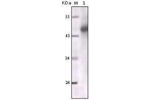 Western blot analysis using CK mouse mAb against truncated CK5 recombinant protein. (pan Keratin antibody)