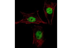 Immunofluorescence (IF) image for anti-Mesenchyme Homeobox 2 (MEOX2) antibody (ABIN3000188)