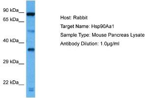 Western Blotting (WB) image for anti-Heat Shock Protein 90kDa alpha (Cytosolic), Class A Member 1 (HSP90AA1) (C-Term) antibody (ABIN2788731)