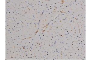ABIN6267510 at 1/200 staining Mouse heart tissue sections by IHC-P. (STAT6 antibody  (pTyr641))