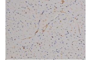 ABIN6267510 at 1/200 staining Mouse heart tissue sections by IHC-P.