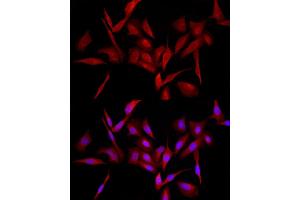 Immunofluorescence analysis of U2OS cells using MyD88 Rabbit pAb (ABIN3021213, ABIN3021214, ABIN3021215, ABIN1513232 and ABIN6214069) at dilution of 1:100 (40x lens). (MYD88 antibody  (AA 60-309))