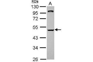 WB Image Sample (30 ug of whole cell lysate) A: HeLa 10% SDS PAGE antibody diluted at 1:5000 (Caspase 1 antibody)