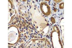 Immunohistochemistry of paraffin-embedded Human kidney using NME2 Polyclonal Antibody at dilution of 1:100 (40x lens). (NME2 antibody)