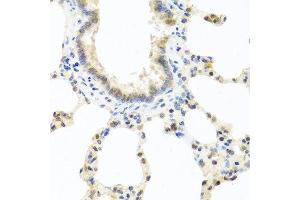 Immunohistochemistry of paraffin-embedded rat lung using DEDD antibody at dilution of 1:100 (40x lens).