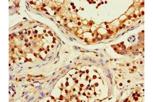 Immunohistochemistry of paraffin-embedded human testis tissue using ABIN7167735 at dilution of 1:100 (RFPL4B antibody  (AA 1-263))