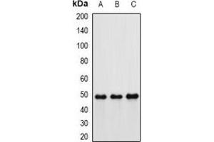 Western blot analysis of Hippi expression in MCF7 (A), mouse kidney (B), rat lung (C) whole cell lysates. (IFT57 antibody)