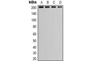 Western blot analysis of TSC2 expression in A549 (A), HEK293T (B), NIH3T3 (C), mouse kidney (D) whole cell lysates. (Tuberin antibody)