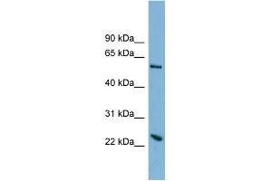 WB Suggested Anti-TMEM161A Antibody Titration:  0. (TMEM161A antibody  (Middle Region))