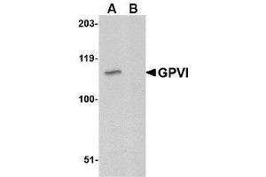 Image no. 1 for anti-Glycoprotein VI (Platelet) (GP6) (C-Term) antibody (ABIN342705) (GP6 antibody  (C-Term))