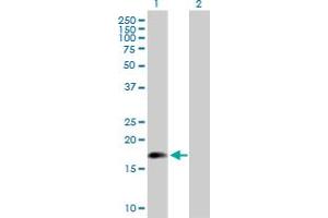 Western Blot analysis of ARL5A expression in transfected 293T cell line by ARL5A MaxPab polyclonal antibody. (ARL5A antibody  (AA 1-179))