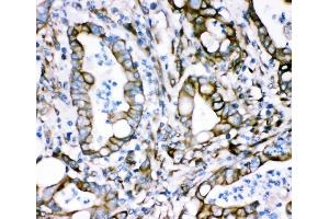 IHC analysis of Plectin using anti-Plectin antibody (ABIN3043900). (PLEC antibody  (Middle Region))