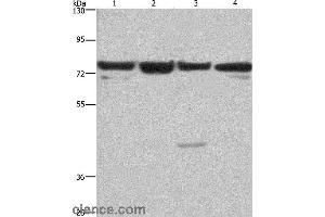 Western blot analysis of HUVEC, NIH/3T3, Hela and 293T cell, using KLF11 Polyclonal Antibody at dilution of 1:350