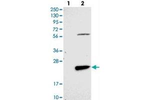 Western blot analysis of Lane 1: Negative control (vector only transfected HEK293T lysate), Lane 2: Over-expression Lysate (Co-expressed with a C-terminal myc-DDK tag (~3. (FAM167B antibody)