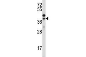 Western blot testing of CTGF antibody and NCI-H460 lysate (CTGF antibody  (AA 166-193))