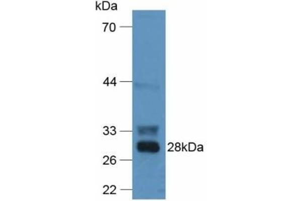 F12 anticorps  (AA 352-587)