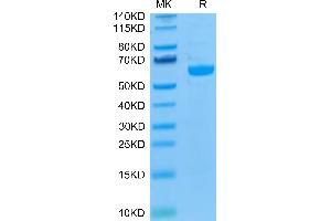 Biotinylated Human LAG3 on Tris-Bis PAGE under reduced condition. (LAG3 Protein (AA 23-434) (His-Avi Tag,Biotin))