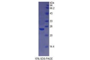 SDS-PAGE analysis of Cow MHCDRa Protein. (HLA-DRA Protein)