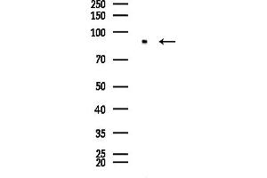anti-PNN-Interacting Serine/arginine-Rich Protein (PNISR) (Internal Region) antibody