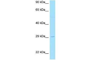 Western Blotting (WB) image for anti-Linker For Activation of T Cells Family, Member 2 (LAT2) (C-Term) antibody (ABIN2789575)
