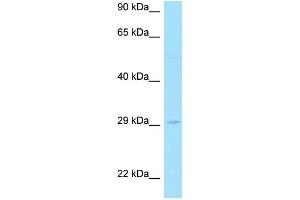 WB Suggested Anti-LAT2 AntibodyTitration: 1. (LAT2 antibody  (C-Term))