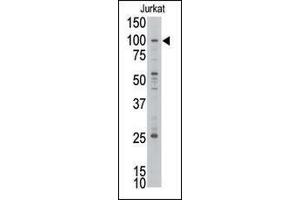 Image no. 1 for anti-Protein AF-10 (MLLT10) (C-Term) antibody (ABIN358670) (MLLT10 antibody  (C-Term))