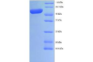 SDS-PAGE (SDS) image for LIM and SH3 Protein 1 (LASP1) (AA 1-243), (partial) protein (GST tag) (ABIN4976301)
